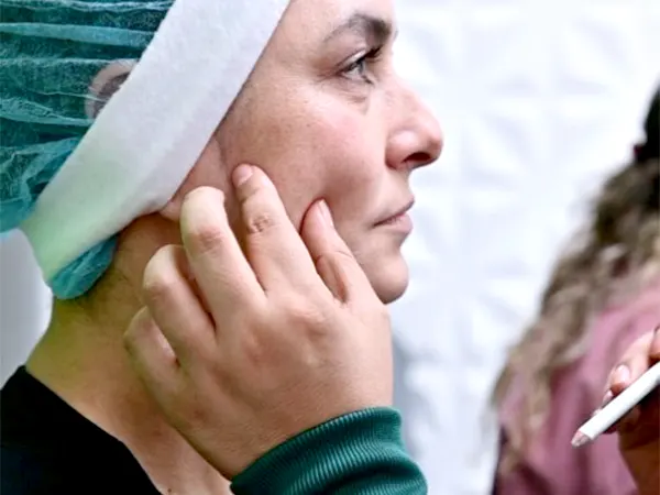 Img-Figura_Piel_Laser-Promos-Hilos_Espiculados